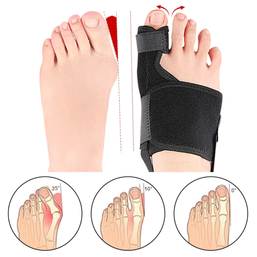 Aligna - För ökad komfort vid hallux valgus